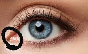 Juckende augen sind nicht nur unangenehm, sondern können auch anzeichen für eine erkrankung sein. Auge Juckt Plotzlich Gesundheit Arzt Augen