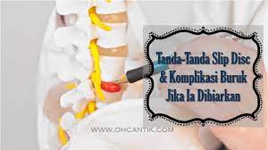 Nyeri kaki juga bisa menjadi tanda kolesterol tinggi lainnya. Tanda Tanda Slip Disc Komplikasi Buruk Jika Dibiarkan Ohcantik Com