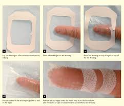 Image result for Occlusive Dressing