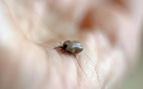 Image result for Tick Bite