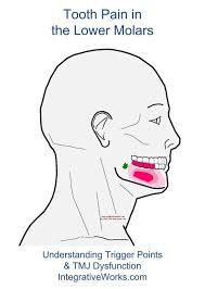 Pin On Tooth And Sinus Trigger Point Pain