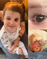 It started with a bloodshot eye. At first, her parents thought it was  nothing — a burst vessel, maybe from rubbing too hard. But when the  swelling didn't fade, her mother's instinct