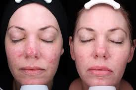 Audrey Sams•CAE (@aesthetics_by_audrey) • Instagram photos and videos