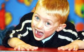 Callum was born 17 weeks early and given a ten percent chance of survival