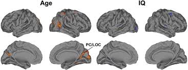 Asperger syndrome (also referred to as asperger disorder) is a term applied to a form of autism spectrum disorder (asd) asperger syndrome is a term applied to a condition characterized by persistent impairment in social interactions and by repetitive behavior patterns and restricted interests. The Brains Of High Functioning Autistic Individuals Do Not Synchronize With Those Of Others Sciencedirect
