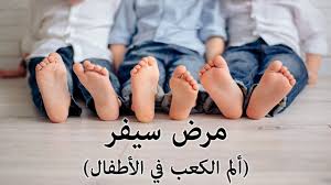 Looking for online definition of cvr or what cvr stands for? Ø§Ù„Ù… Ø§Ù„ÙƒØ¹Ø¨ ÙÙ‰ Ø§Ù„Ø£Ø·ÙØ§Ù„ Ù…Ø±Ø¶ Ø³ÙŠÙØ± Sever S Disease Youtube