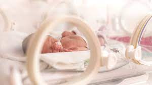 premature bebek annelerinin merak ettigi 10 soru anne baba