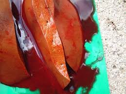 Image result for Copper Poisoning