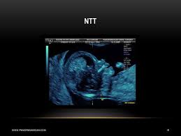 Online Ultrasound Courses First Trimester Trimester Ultrasound