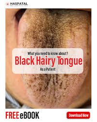 Image result for black hairy tongue symptoms