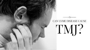 Can Lyme Disease Cause Tmj Donald R Tanenbaum Dds Mph