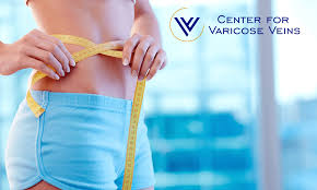 3 signs to know if you are really fat or just bloated Why Are My Varicose Veins More Visible Since Losing Weight Vinay Madan Md Dabvlm Board Certified Vascular And Interventional Radiologist