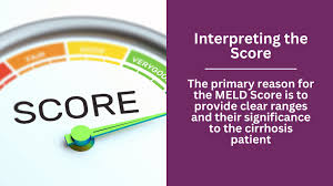 Image result for MELD Score