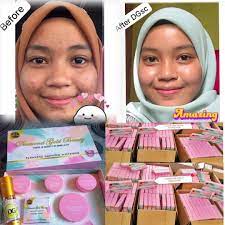 Anda masih mencari cari produk wajah yg sesuai utk kulit muka anda? Diamond Gold Skincare Beauty Sabah Posts Facebook