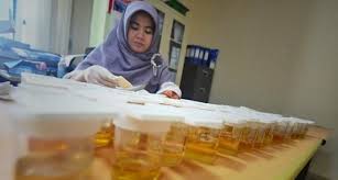 Bahkan infeksi ini bisa menyebar hingga ke seluruh tubuh melalui darah.keputihan berwarna kuning kehijauan yang berbau hanyalah salah satu dari beberapa gejala yang akan muncul. Urine Berwarna Biru Hijau Atau Hitam Ada Apa Gerangan