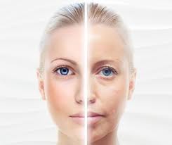 Tixel or tactile pixel is a technology allowing for feel and touch with screens, simulations of wetness and texture, achieved using vibration and electrical fields. Tixel The Beauty Base Luxury Spa Laser Dermal
