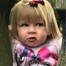 Coarctation of the Aorta: Amy's Story