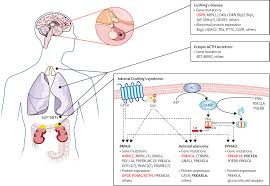 Cushing S Syndrome The Lancet
