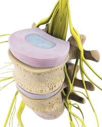 Jede bandscheibe weist einen äußeren faserring (anulus fibrosus) und einen inneren gallertkern (nucleus pulposus) auf. Bandscheibe Gelenk Klinik De