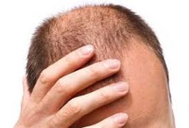 Rever De Perdre Ses Cheveux Signification Et Interpretation En Islam