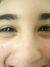 Billy, Author at The Jonah Maccabee Foundation