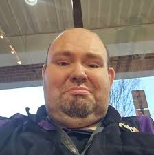 Memory loss pricing in my area