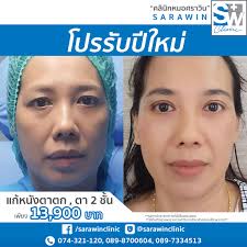 64 จากกรณี นายแพทย์ศราวิน ทองรอง แสดงความเห็นผ่านโซ. à¸„à¸¥ à¸™ à¸à¸«à¸¡à¸­à¸¨à¸£à¸²à¸§ à¸™ à¸„à¸¥ à¸™ à¸à¸¨ à¸¥à¸¢à¸à¸£à¸£à¸¡ Posts Facebook
