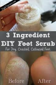 These diy remedies i have tried these foot masks home remedies for cracked heels should be applied and left on the heels for. Diy Vinegar Foot Scrub For Dry Cracked Feet Foot Scrub Diy Foot Scrub Dry Cracked Feet