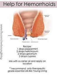 Natural Remedies That Make Hemorrhoids Go Away For Good Young Living Oils Recipes Essential Oils For Hemmoroids Essential Oil For Hemorrhoids