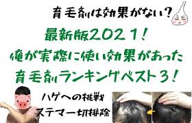 コロナ抜け毛で死ぬ程ハゲたけど １か月半３つの育毛方法でフサフサへ はるいく 2021 aga 治療 抜け毛 育毛