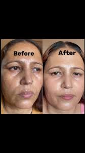 The Hidden Lotus Blooms Twice