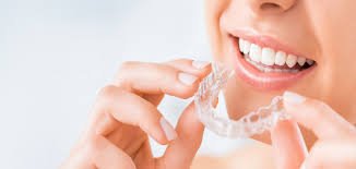 Choosing the Right Invisalign Provider | Dr Singh Dental Center - Tracy, CA
