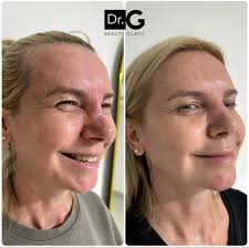 Claroo, lo que el paciente pida 🤐