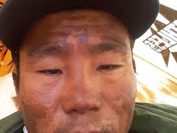 Fundraiser by Marina Cortes : Nima Tshering Sherpa: injured Himalayan  lifesaver