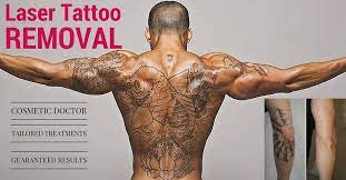 I have no hesitation coming back. Laser Tattoo Removal Gold Coast Oo La La Cosmetic Laser Clinic Surfers Paradse