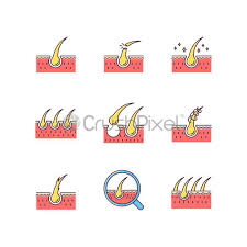 During the telogen phase, which lasts about three months, the hair rests. Hair Loss Rgb Color Icons Set Damaged Hair Unhealthy Roots Stock Vector Crushpixel