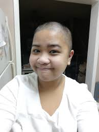 I finally did it! I just shaved all my hair off! Ive been dealing with  psoriatic arthritis for 14 years! My biggest problem spot is my head and  having long hair made
