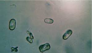 Fr c'est l'oxalate de calcium cristallisé trouvé dans la terre. Oxalat Urinar Cauze È™i Tratament Thepoc