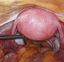 Ein hohlorgan ist ein organ, das mit seinem biologischen gewebe einen hohlraum (lumen) zu den hohlorganen zählen: Gebarmutter Wikipedia