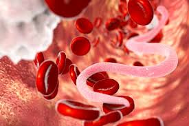 Iata ce indica un vsh marit si ce este de facut. Vsh MÄrit La Copil Qbebe Ro