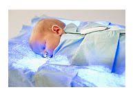 Informatii utile despre icter la nou nascuti. Icterul La Nou Nascuti Hiperbilirubinemia