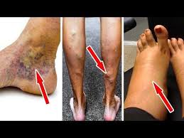 Pin On Body Good Tips