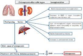 Pathophysiology Of Osteoporosis Genes Oxidative Stress And Immunopathogeny A Qualitative Systematic Review