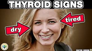 Kathy Soliz's Journey: Overcoming Hypothyroidism with Total Thyroid Fix