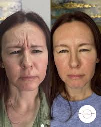 🌟 Join us in welcoming Meghan Bates, PA-C! Originally from Charlotte, NC,  Meghan earned her degree from Clemson and completed her PA training at  Weill Cornell in NYC. She began her career