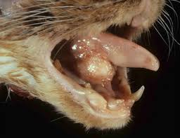 Oral carcinomas have been reported in the oropharynx, mandibular fauces. Cancersquamous