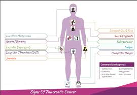 If you have these even though it's an uncommon diagnosis, pancreatic cancer is very aggressive. 7 Early Warning Signs Of Pancreatic Cancer 99 Health Ideas
