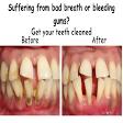 Tooth cleaning product image