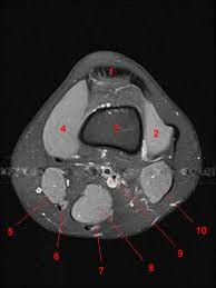This webpage provides a gallery of images that presents the anatomical structures found on knee mri. Atlas Of Knee Mri Anatomy W Radiology