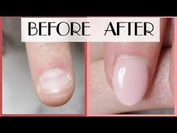 Nail Biter Transformation With Gel Young Nails Concealer Pink Gel Youtube It is sometimes described as a parafunctional activity, the common use of the mouth for an activity other than speaking, eating, or drinking. nail biter transformation with gel young nails concealer pink gel